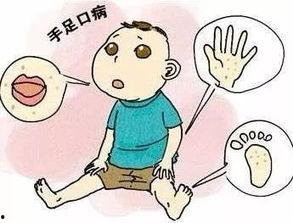 成人惊厥的症状发作视频,成人惊厥症状瞬间捕捉