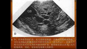 成人洗眼睛视频大全教程,视频教程大全解析